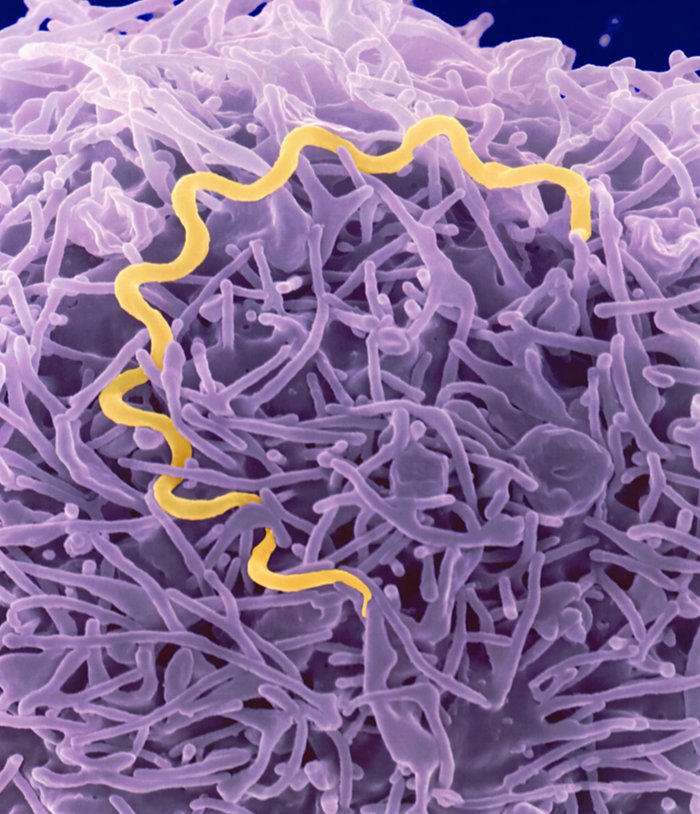 Spirituality Science - Behold The Man - Ecce Homo: This Spirochete bacterium known as Treponema pallidum which had infected Nietzsche had eventually wiped out his mortal existence. This Syphilitic infection causes Meningoencephalitis, inflammation of the brain and nerve tissues that destroys cerebral cortex leading to general dissolution and death within 3 to 10 years after the onset of clinical symptoms of brain involvement.